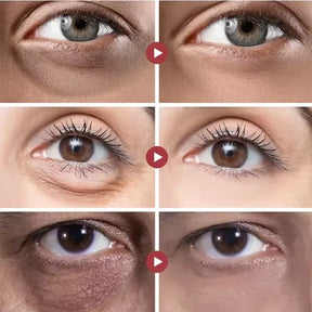 Rolon 5 em 1 Ultra Rejuvenescedor Luteína Inova®